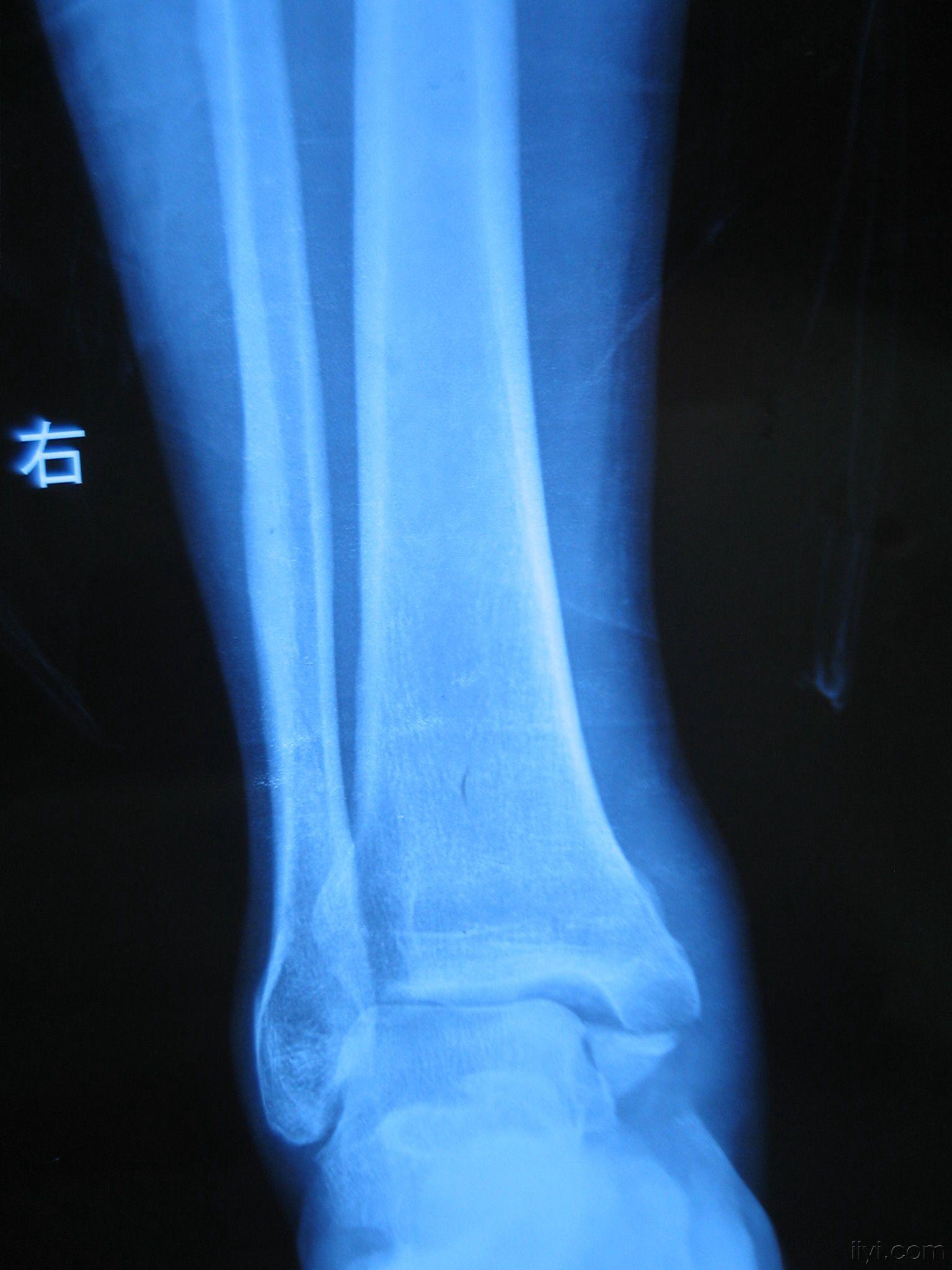 20080220_70da261eda87552af96dJLiiZfaxKBdH.jpg