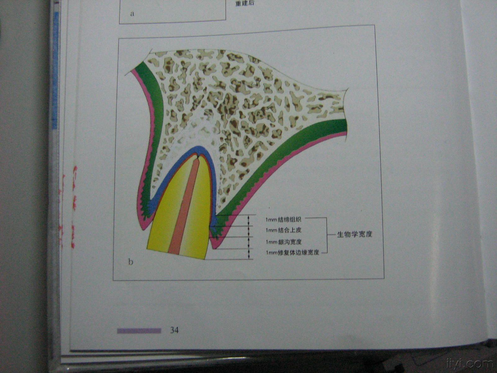 生物学宽度图示