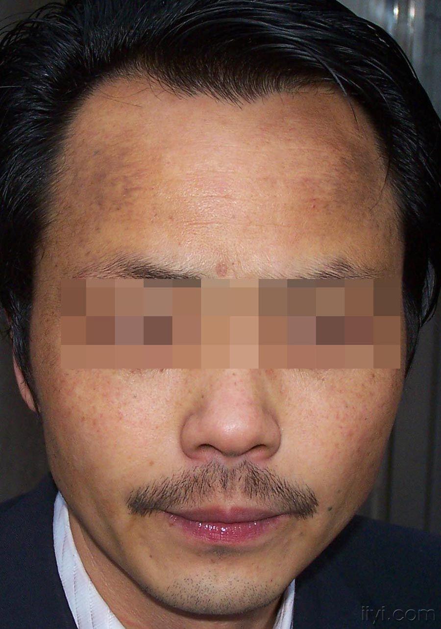 请大家帮忙分析一下这个病例多谢了