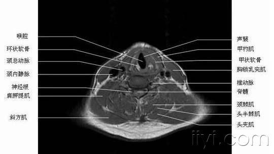 正常喉部示意图