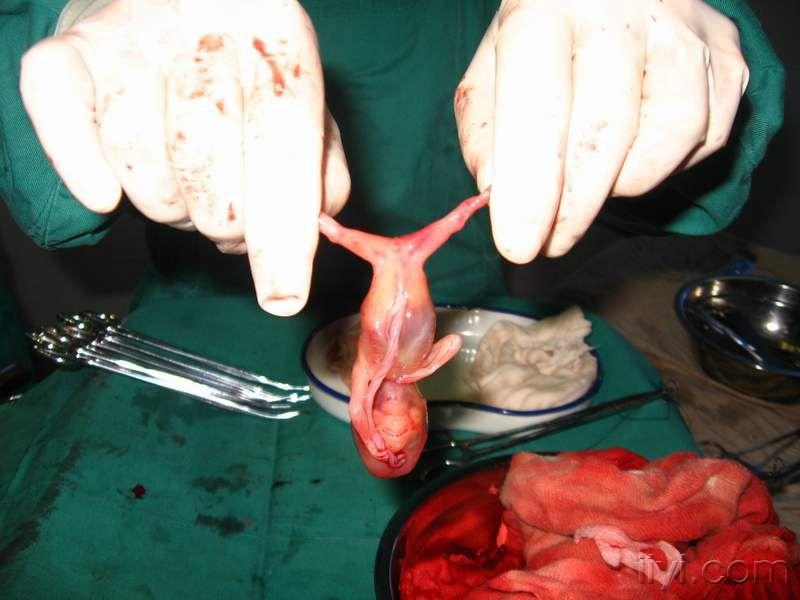 孕期12周的胎儿的图片图片