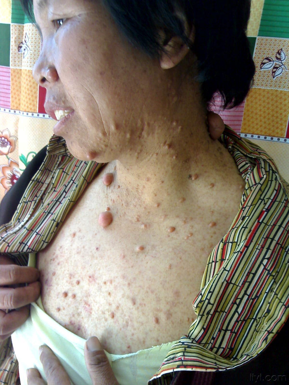 罕见的病例【图】请版主尽快给解答!谢谢