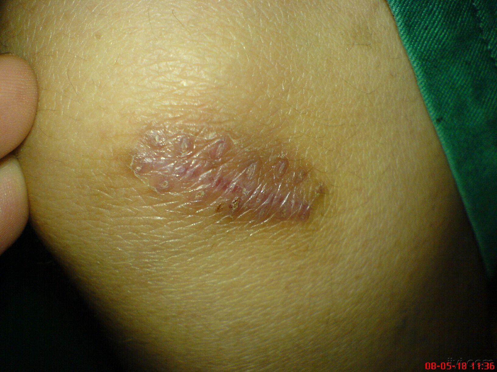 20080520_222cfc437ef5cd756dde7HZFHTEM27f4.jpg