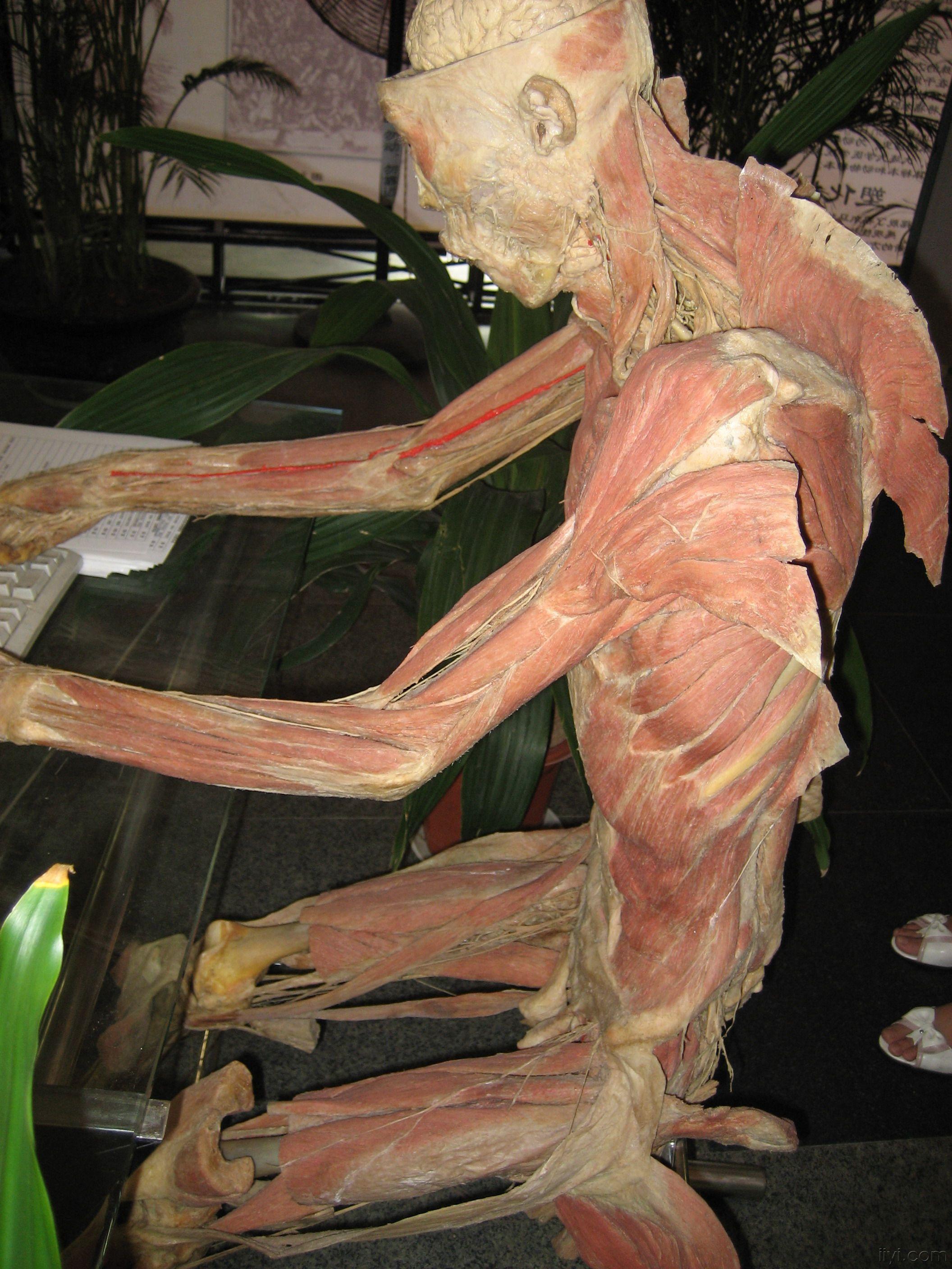 人体解剖标本实体图片