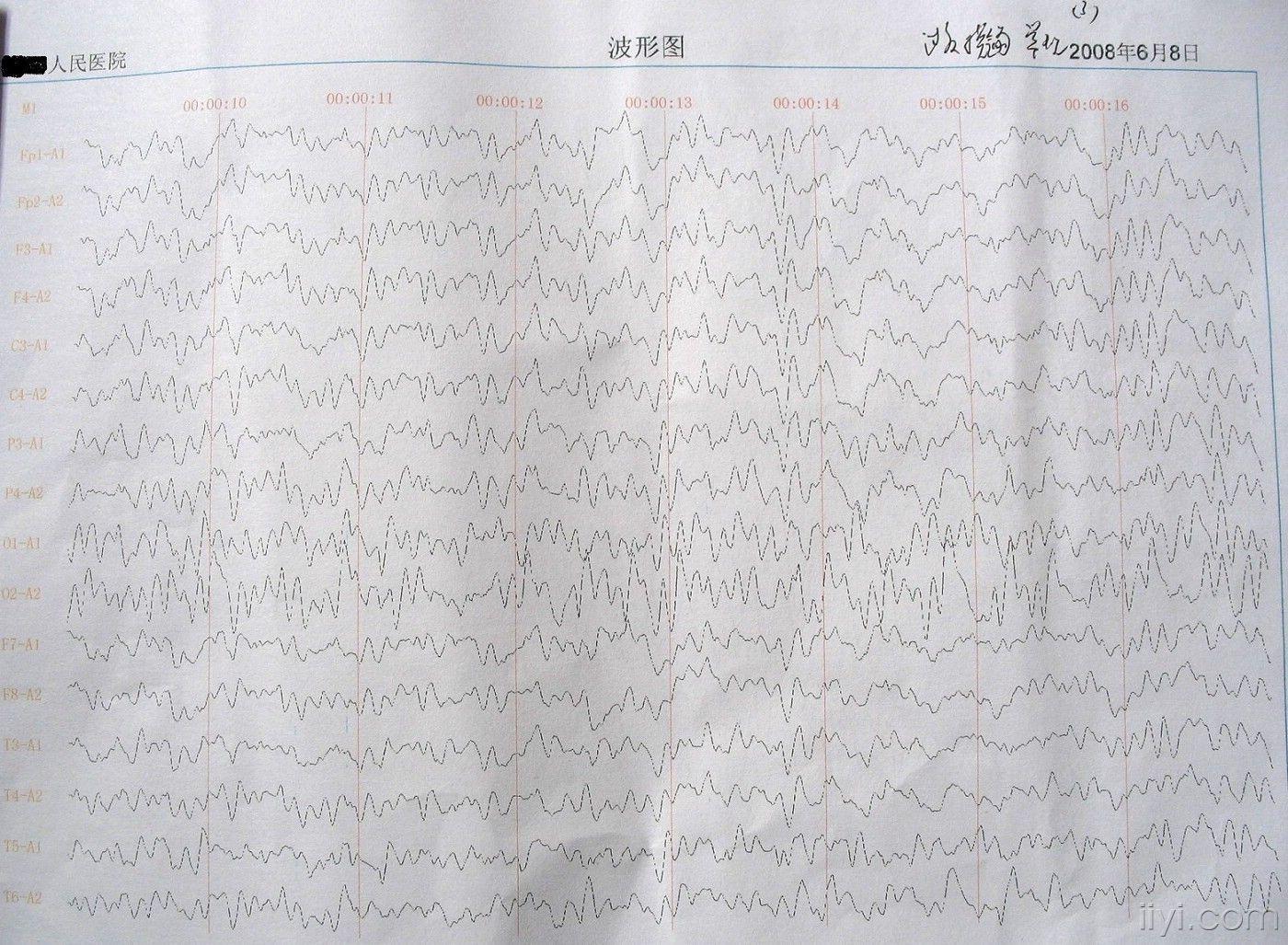 6月8日早7点孩子又肚子疼做脑电图为异常已贴图谢谢
