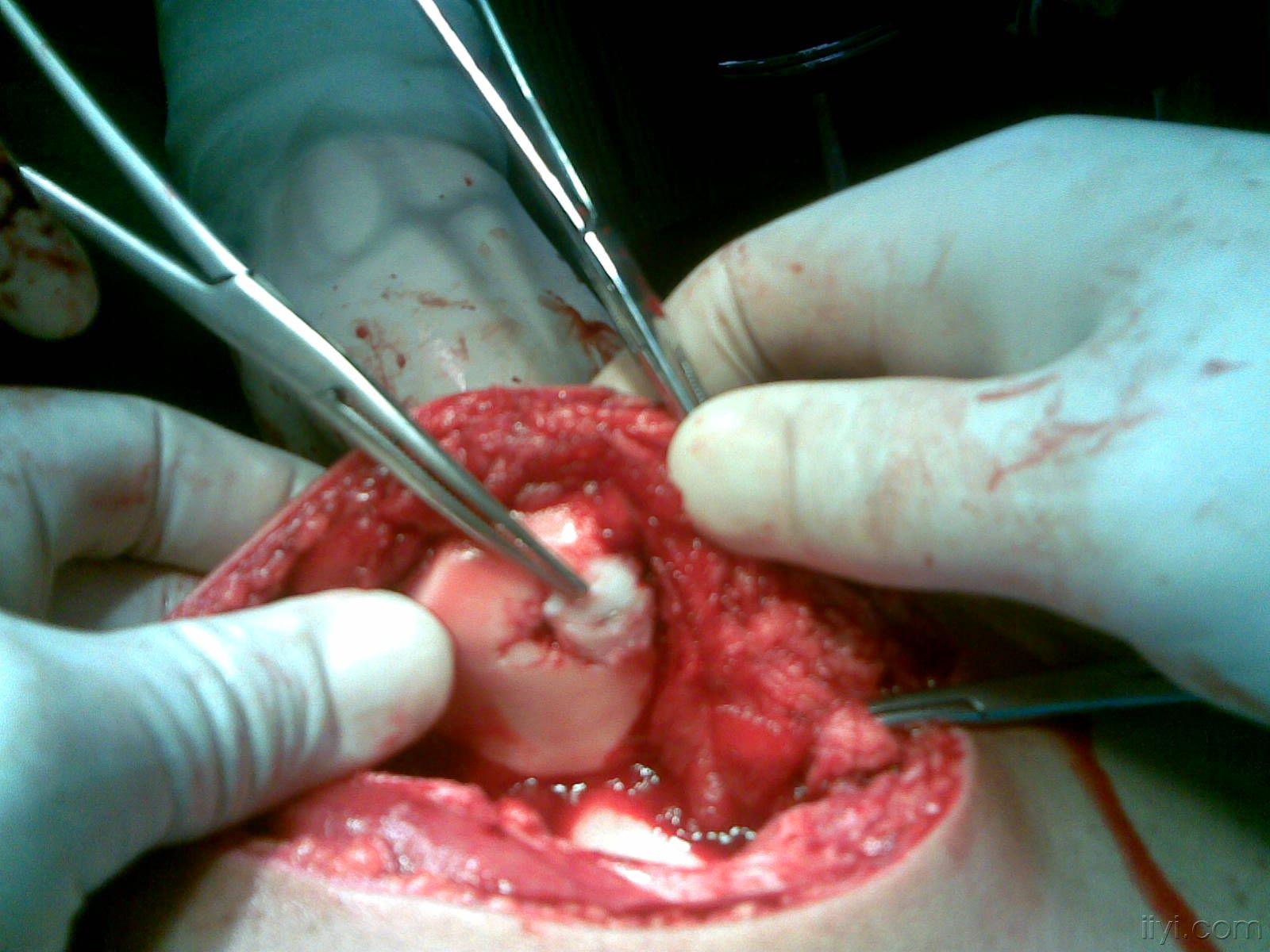 从x线上诊断答案已经有了各位同人请看看啊