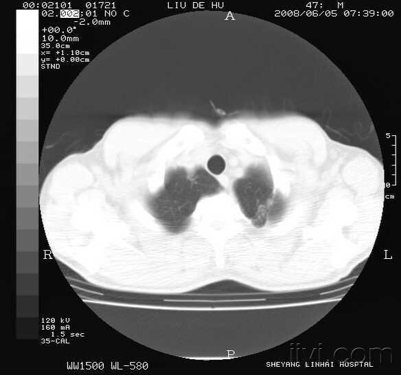 医学影像学讨论版 - 爱爱医医学论坛