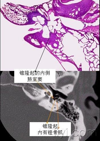 鼓窦乳突图片