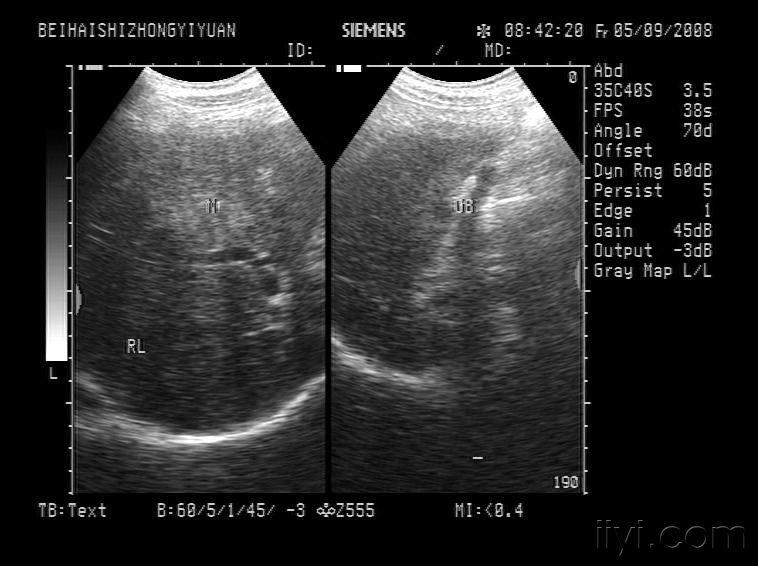讨论请帮忙看这个是副脾还是淋巴结