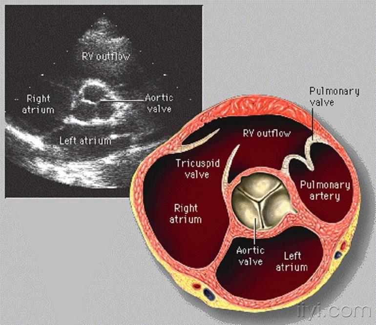 【讨论】主动脉瓣声像图 - 超声医学讨论版 - 爱爱医医学论坛