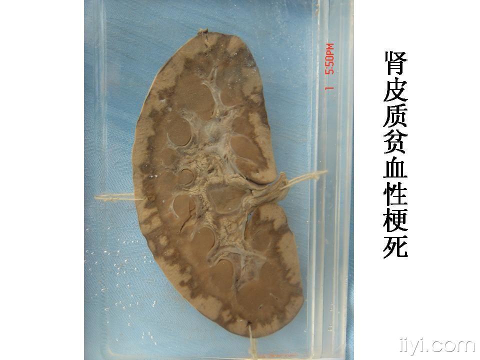 我校珍藏的大体标本图片