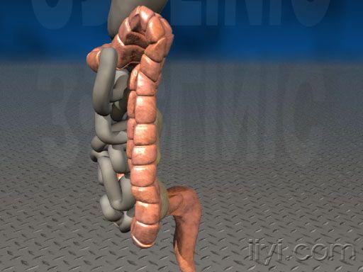f201385_largeintestine2.jpg