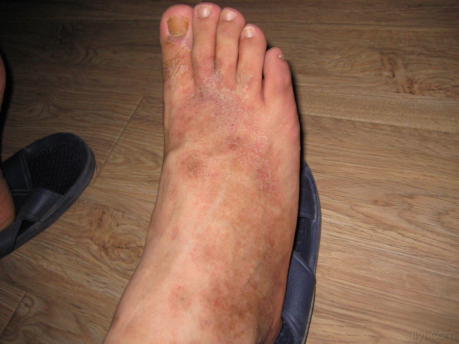 大家都来看看这个疑难的病例吧至今诊断模糊疗效欠佳