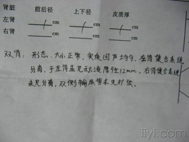 b超简谱