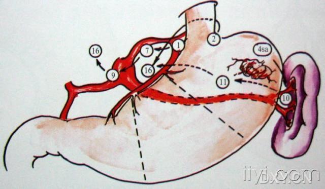 胃淋巴结分区图图片