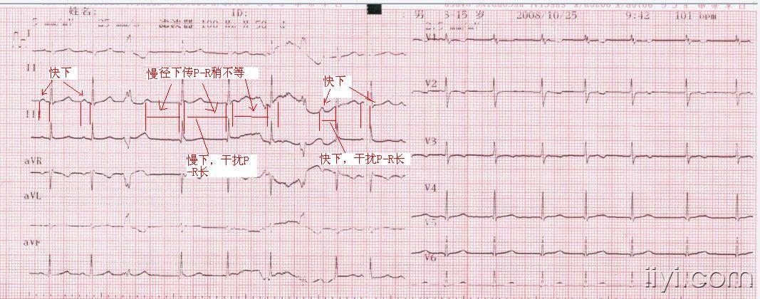心電圖學習群郎中圖