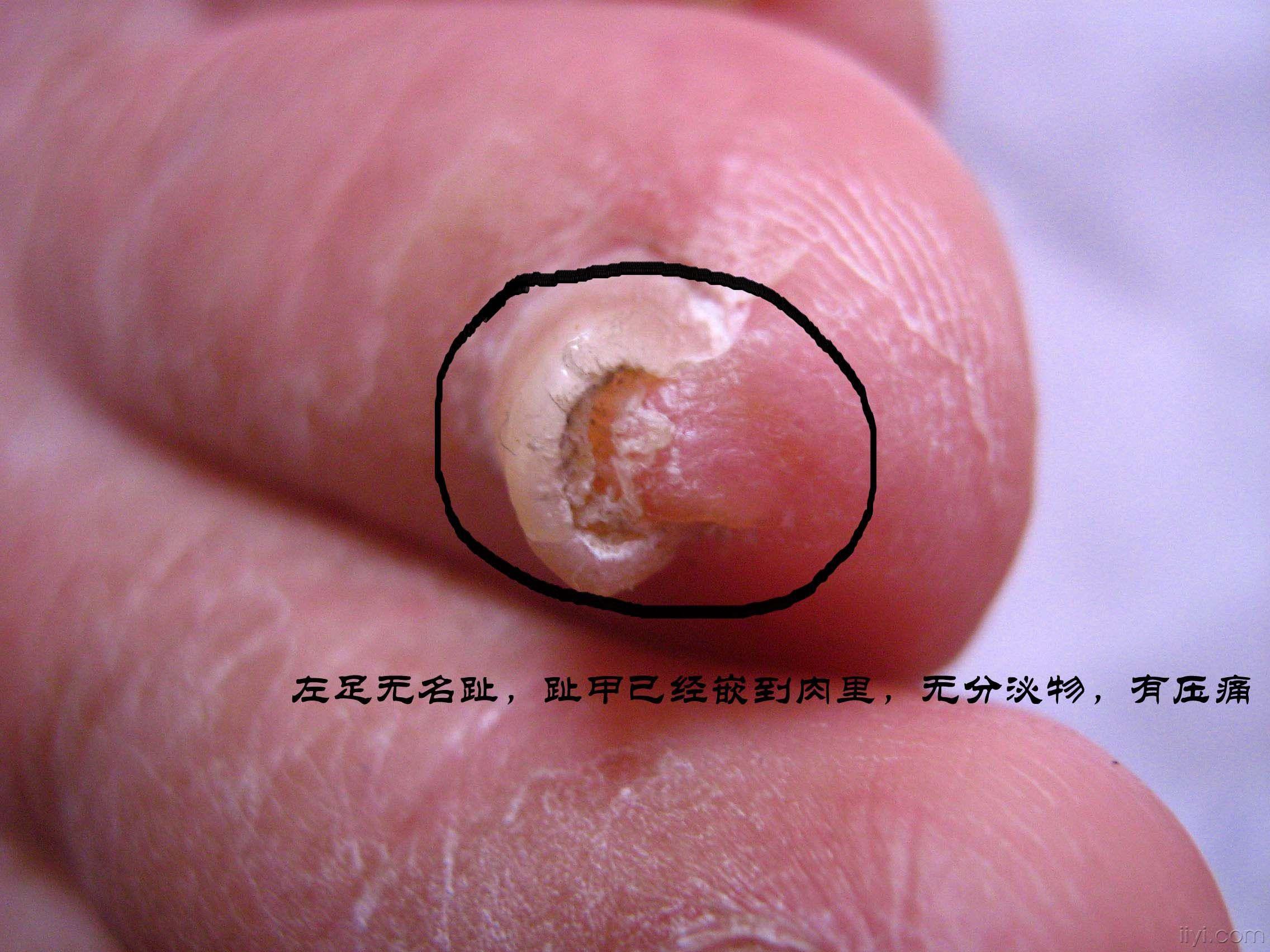 这样的趾甲你见过么?