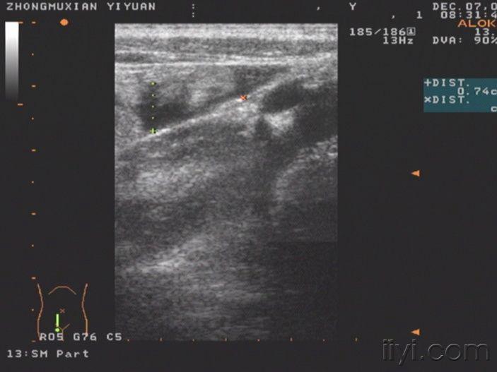 20081207_51cd4f1bcd00cbd37f66HqTpWkln49wz.jpg