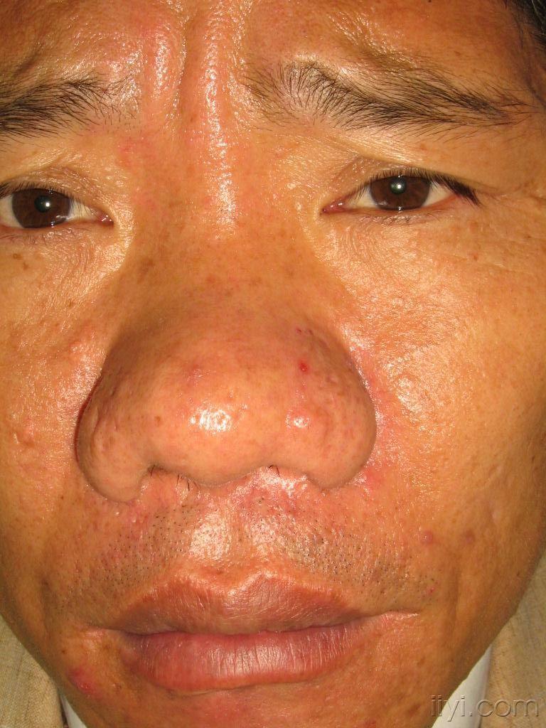 请告诉我如何处理这个酒糟