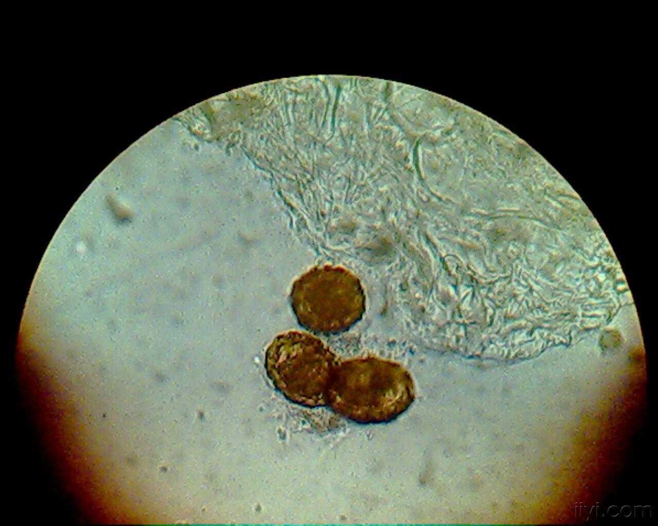 脱蛋白质膜蛔虫卵图片