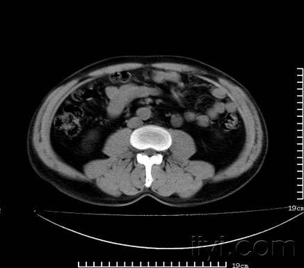 阑尾炎是哪侧腹部疼 20081228_2fac2ace2bd5074228cb4ZOmC05Lt3U1.jpg