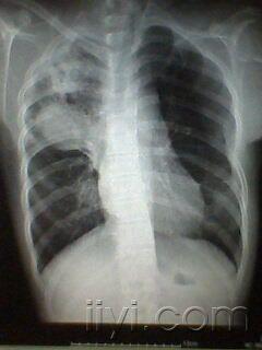 20090121_670ea7395e2aa7687ba9VBxbAebFI2aC.jpg