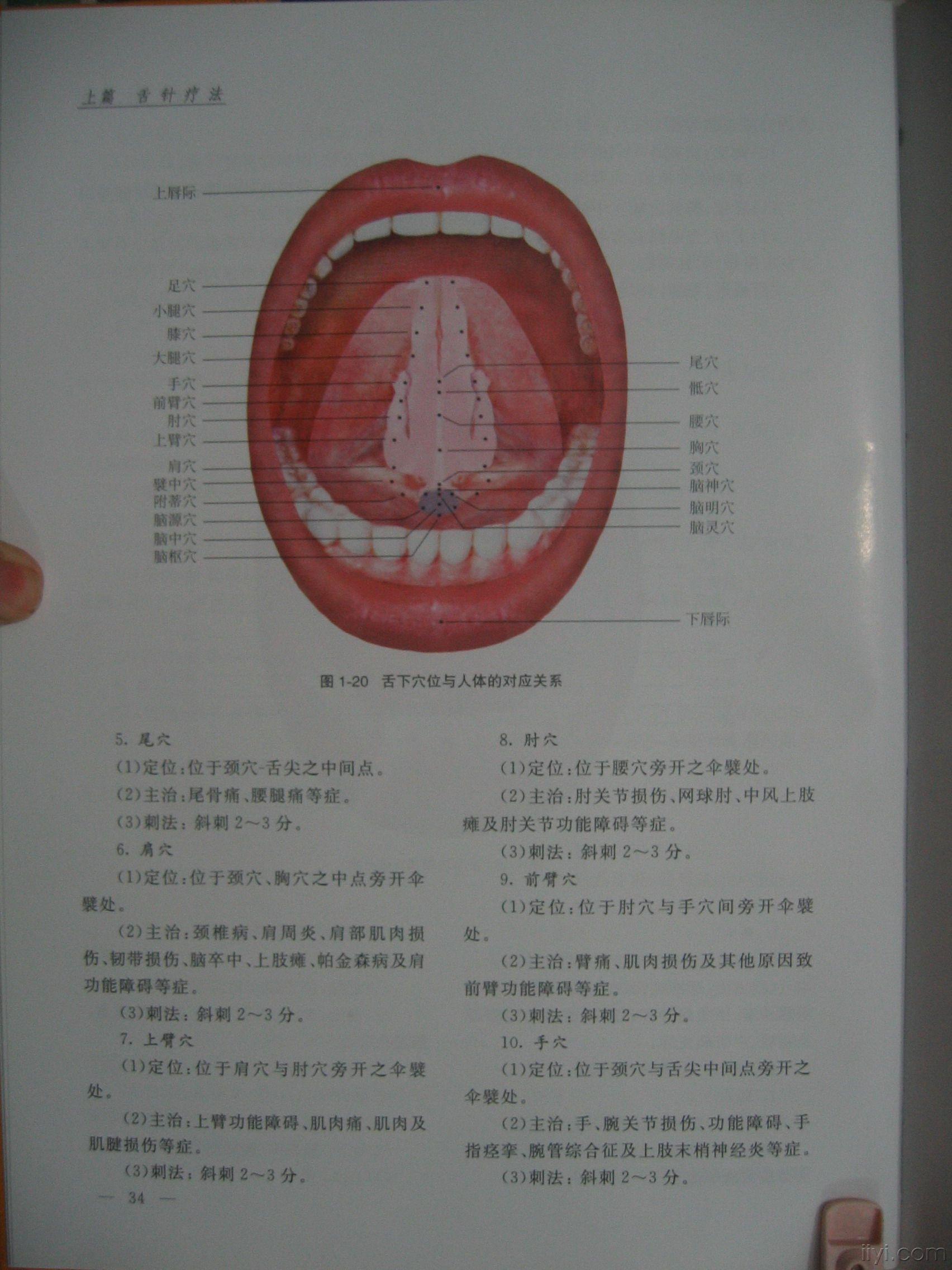 舌针图