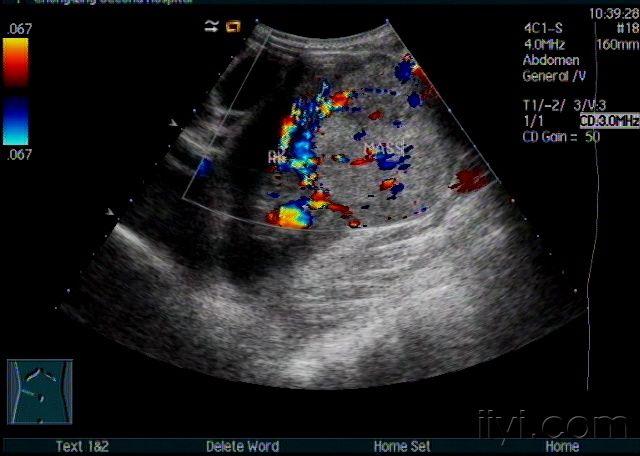 超聲醫學討論版 - 愛愛醫醫學論壇