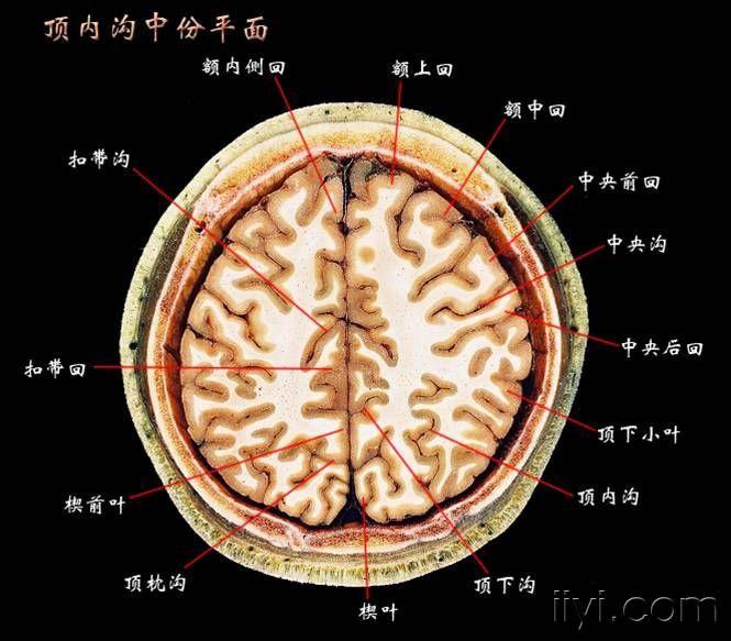 大脑水平切面解剖图片图片