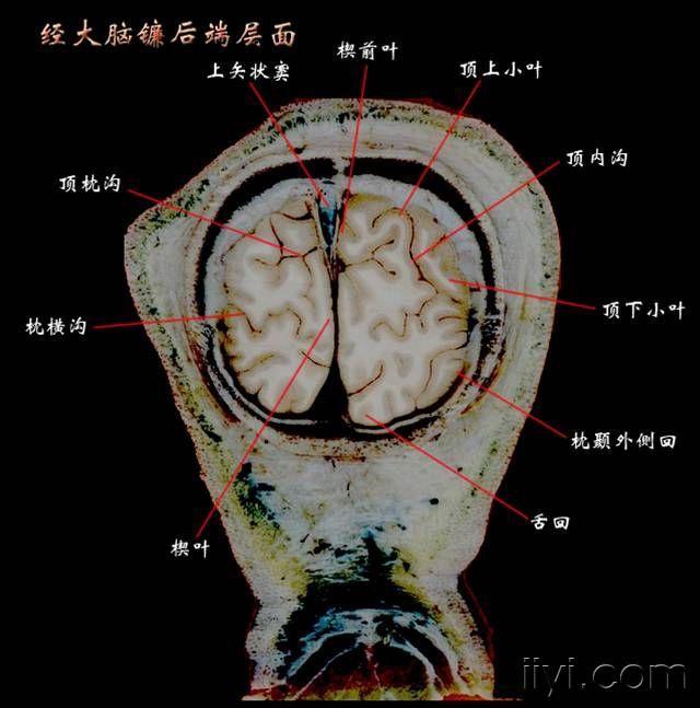 经大脑镰后端层面jpg