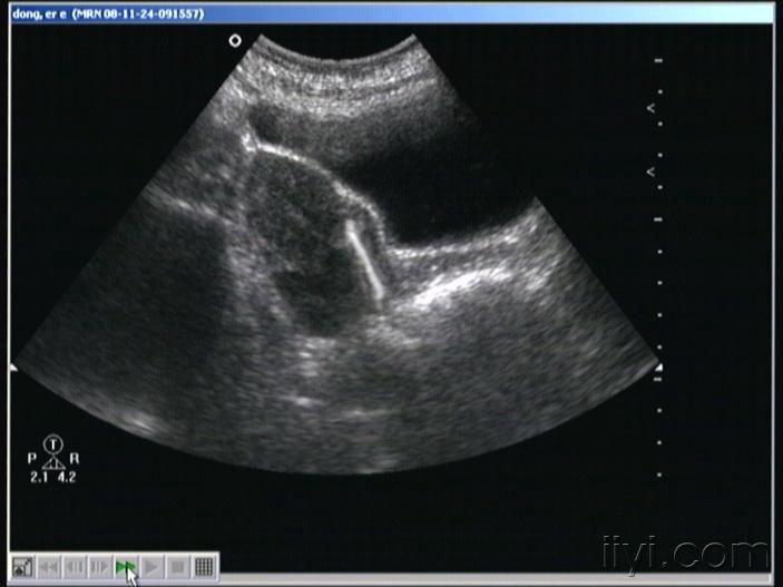 20090221_2f0375be4e9b1d722fa4WIpjppkQwpvg.jpg