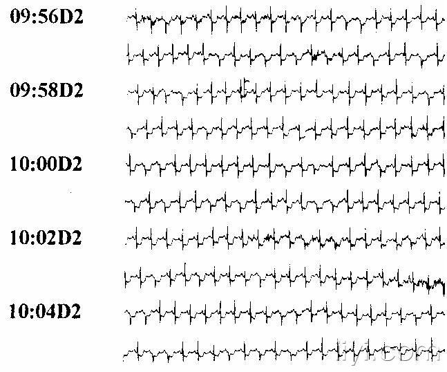 请教24小时心电图监测仪的价钱,哪个牌子好