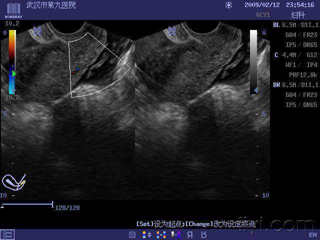 怀孕多久有胚芽组织 20090310_ca77955cf1318fa3430bkRy4D6Q8q9l7.jpg