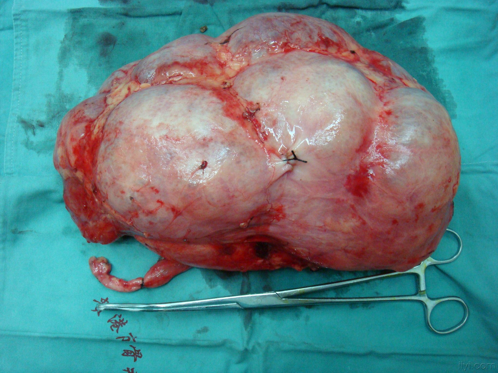 今天切下的巨无霸