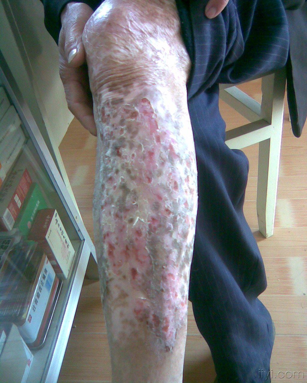 皮肤高手进有图片