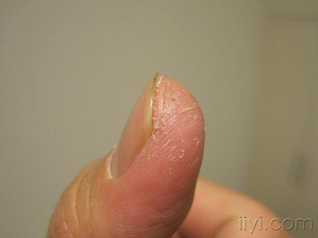 问皮肤科大夫手指上长的是什么啊