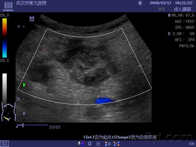 超声医学讨论版 - 爱爱医医学论坛