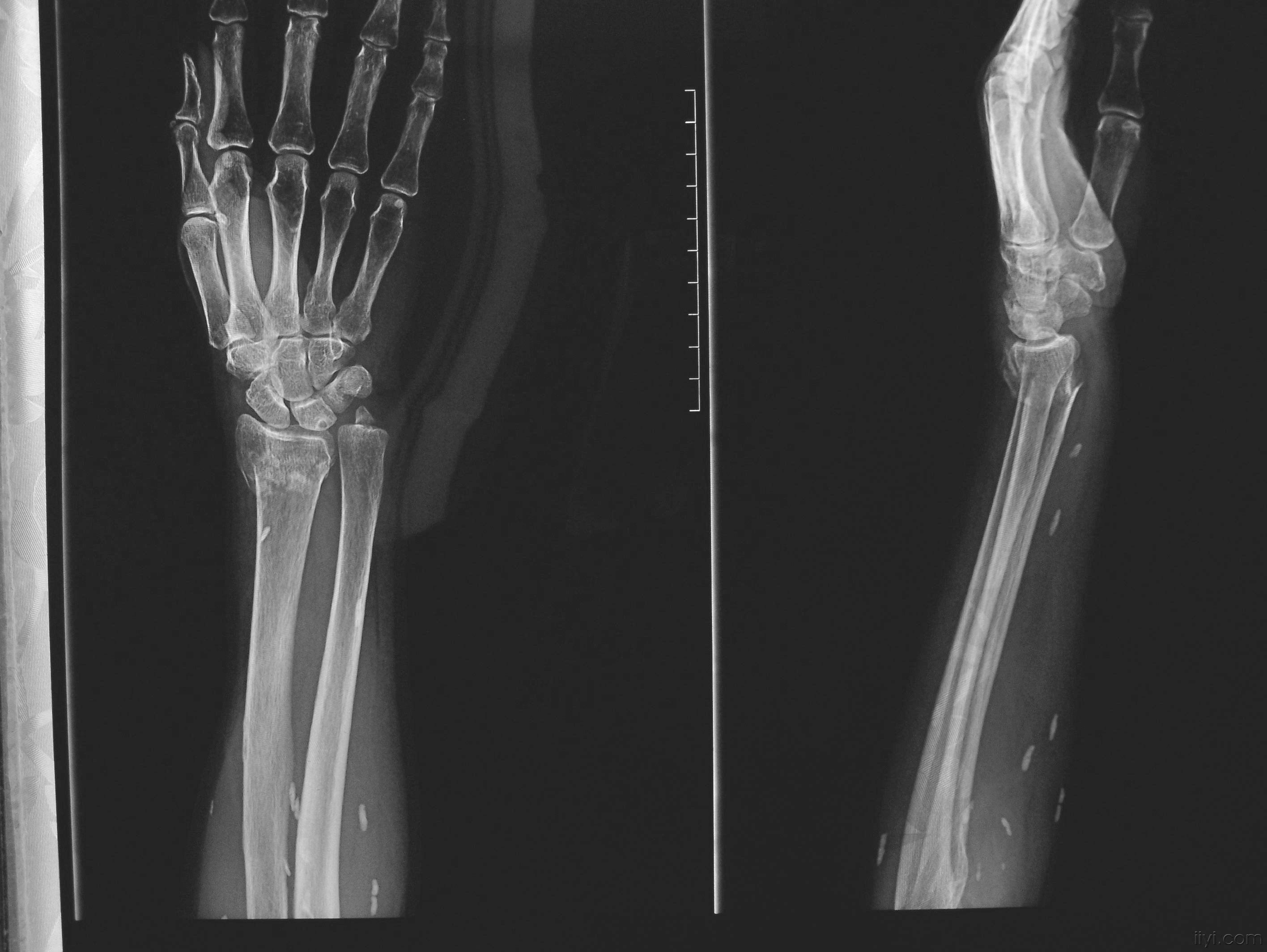 给大家张片子看看 - 医学影像学讨论版 - 爱爱医医学论坛