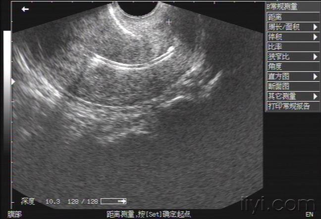 节育环异常 - 超声医学讨论版 - 爱爱医医学论坛