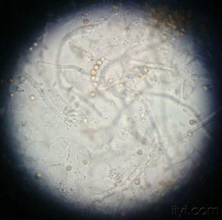 曲霉菌形态图片