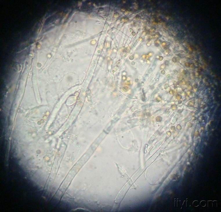 黄曲霉素显微镜下图片图片