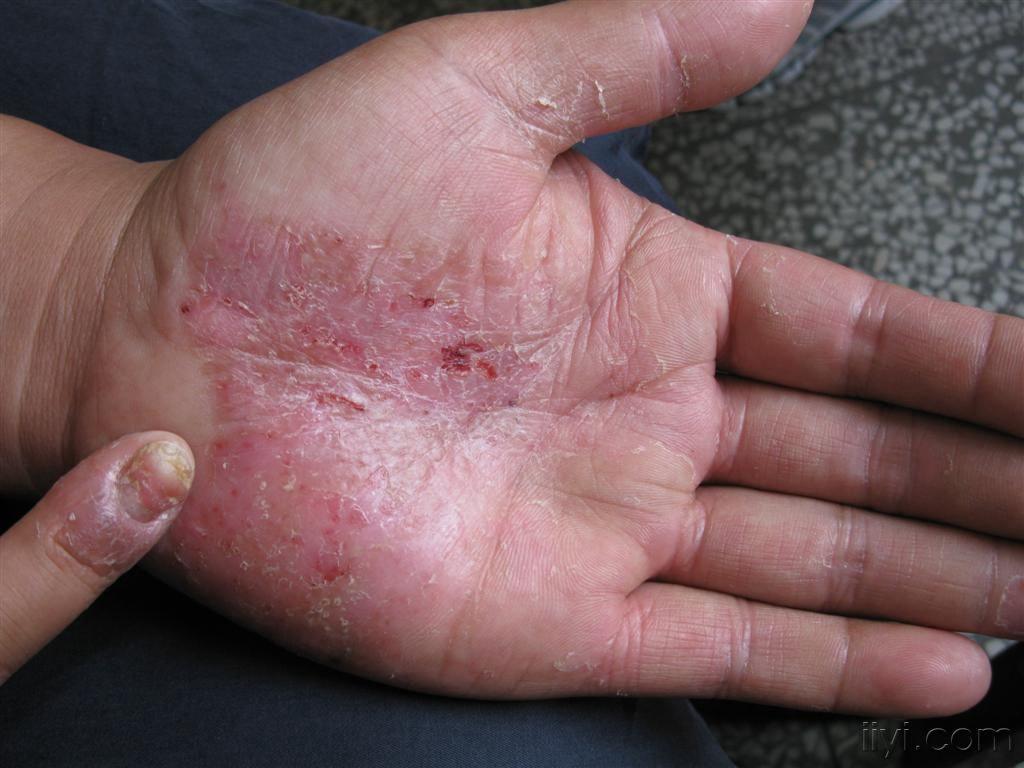 看图识病不问症状只看图