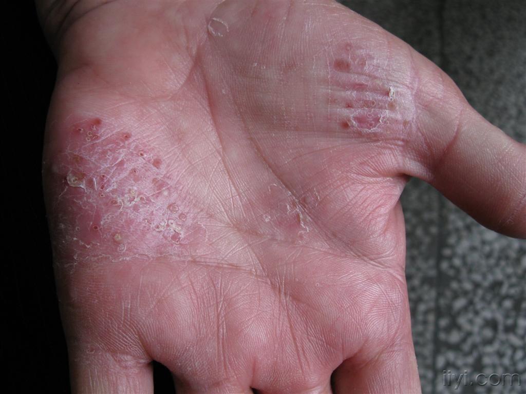 看图识病不问症状只看图