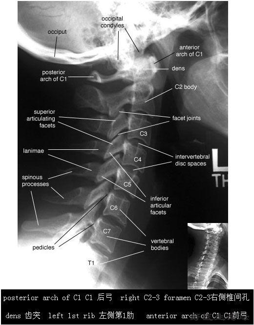颈椎右斜位 jpg