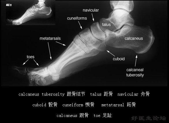 踝关节x线解剖图图片