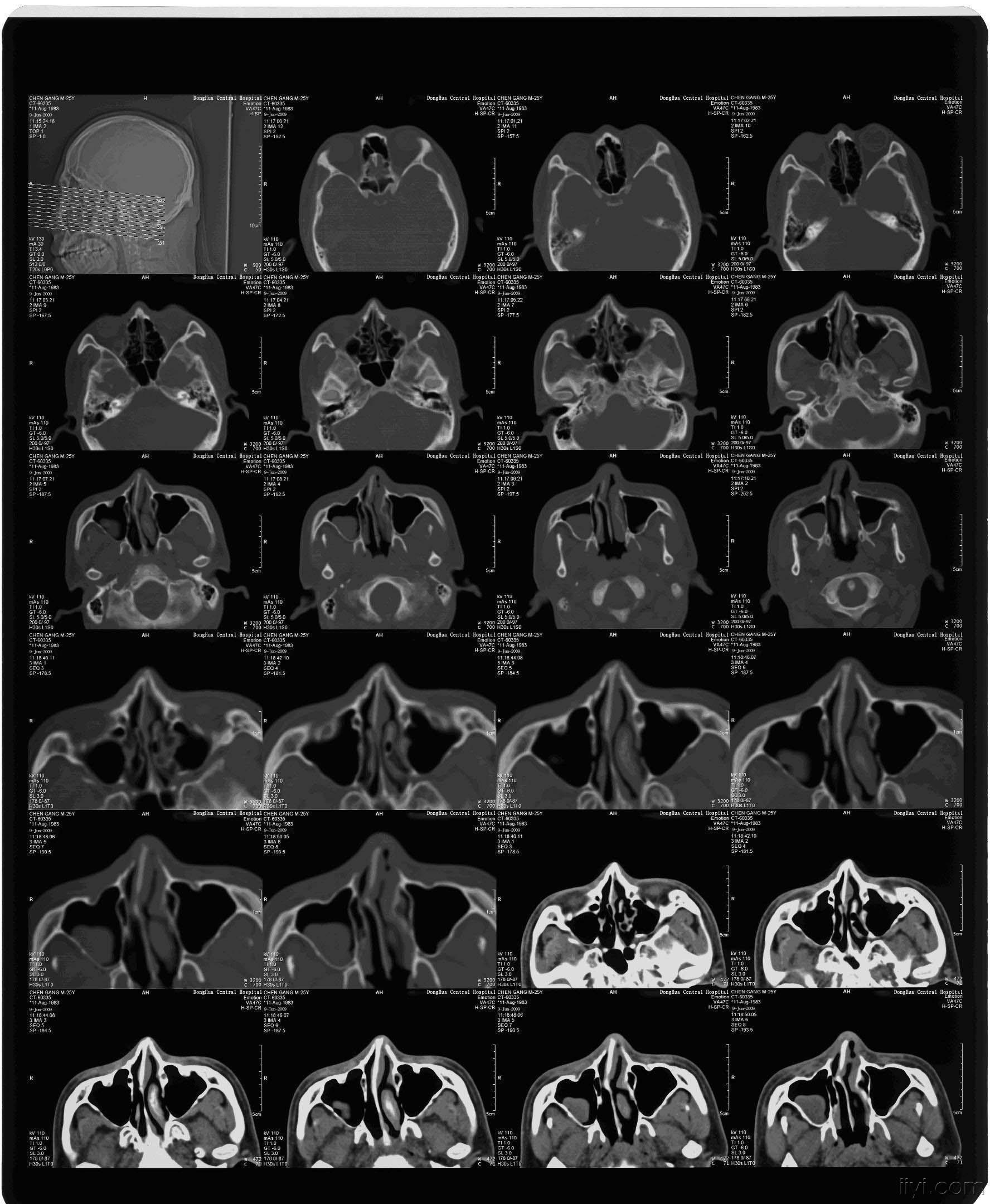 被打请各位同仁帮忙看看这个片子