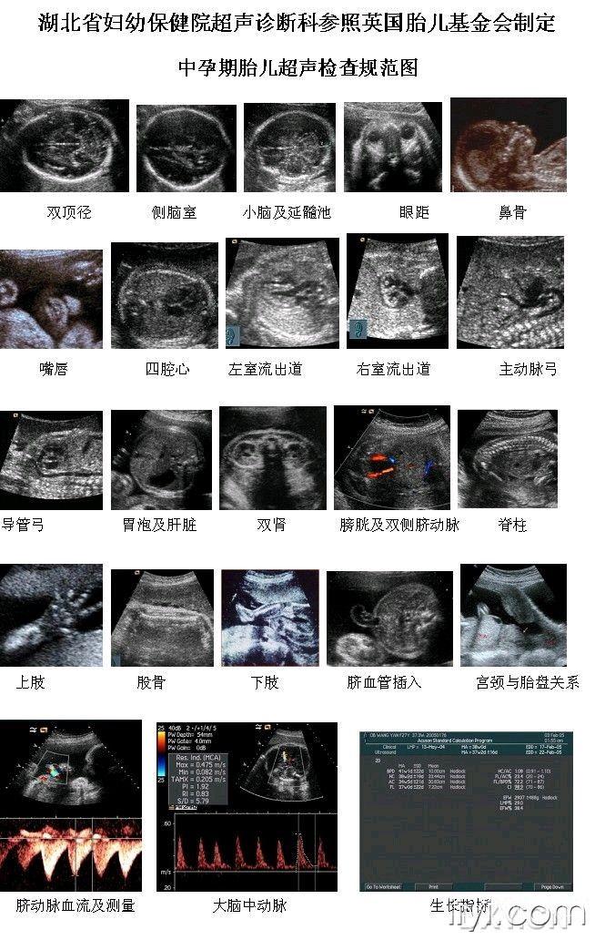 中孕胎儿超声检查规范