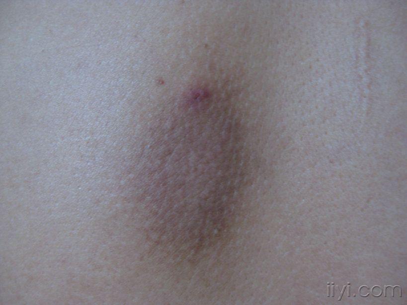 20090807_69867f34d829642300e3lLzvfyylFQAt.jpg