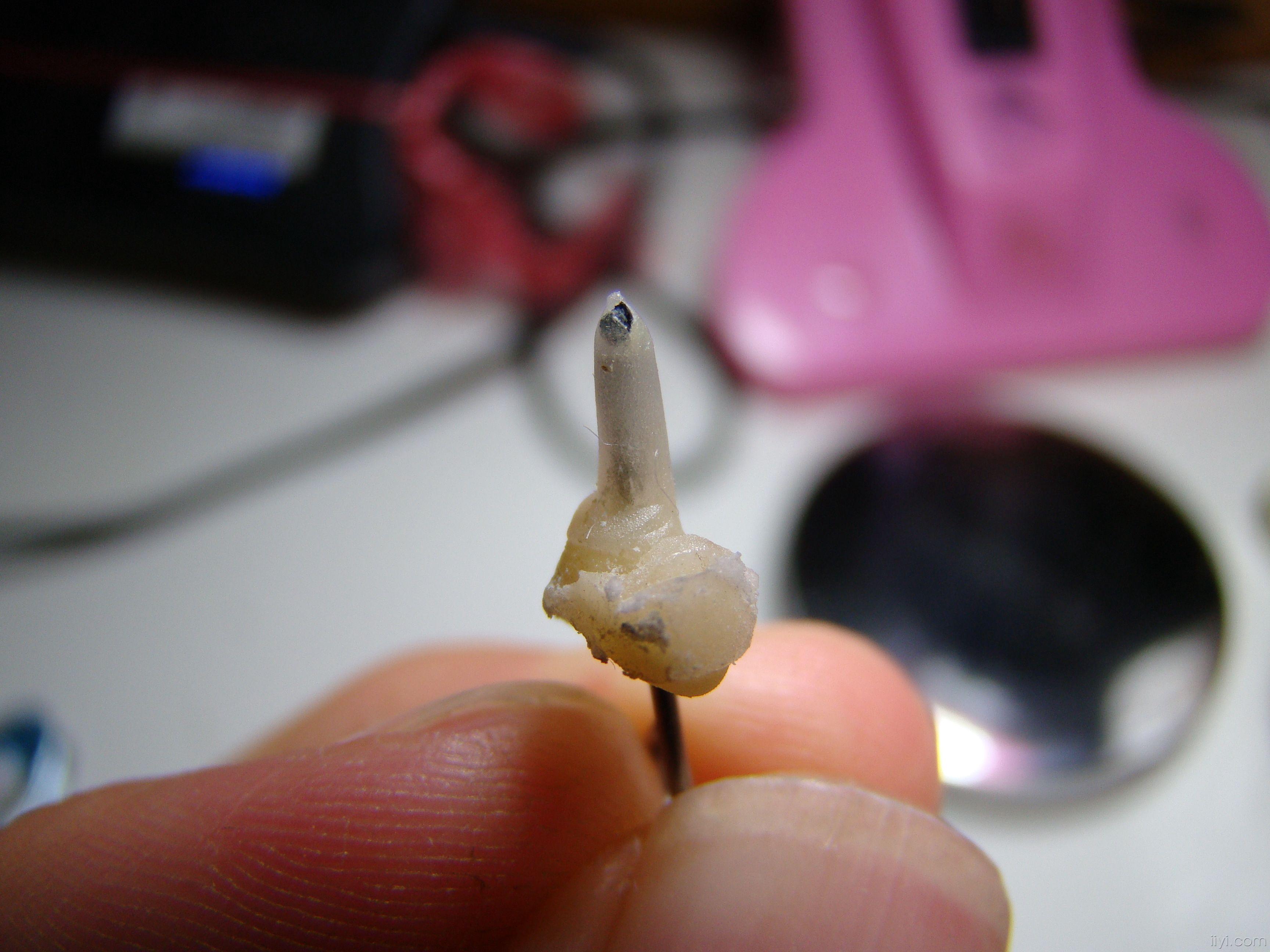 自凝树脂制取根管桩 - 口腔医学专业讨论版 - 爱爱医医学论坛