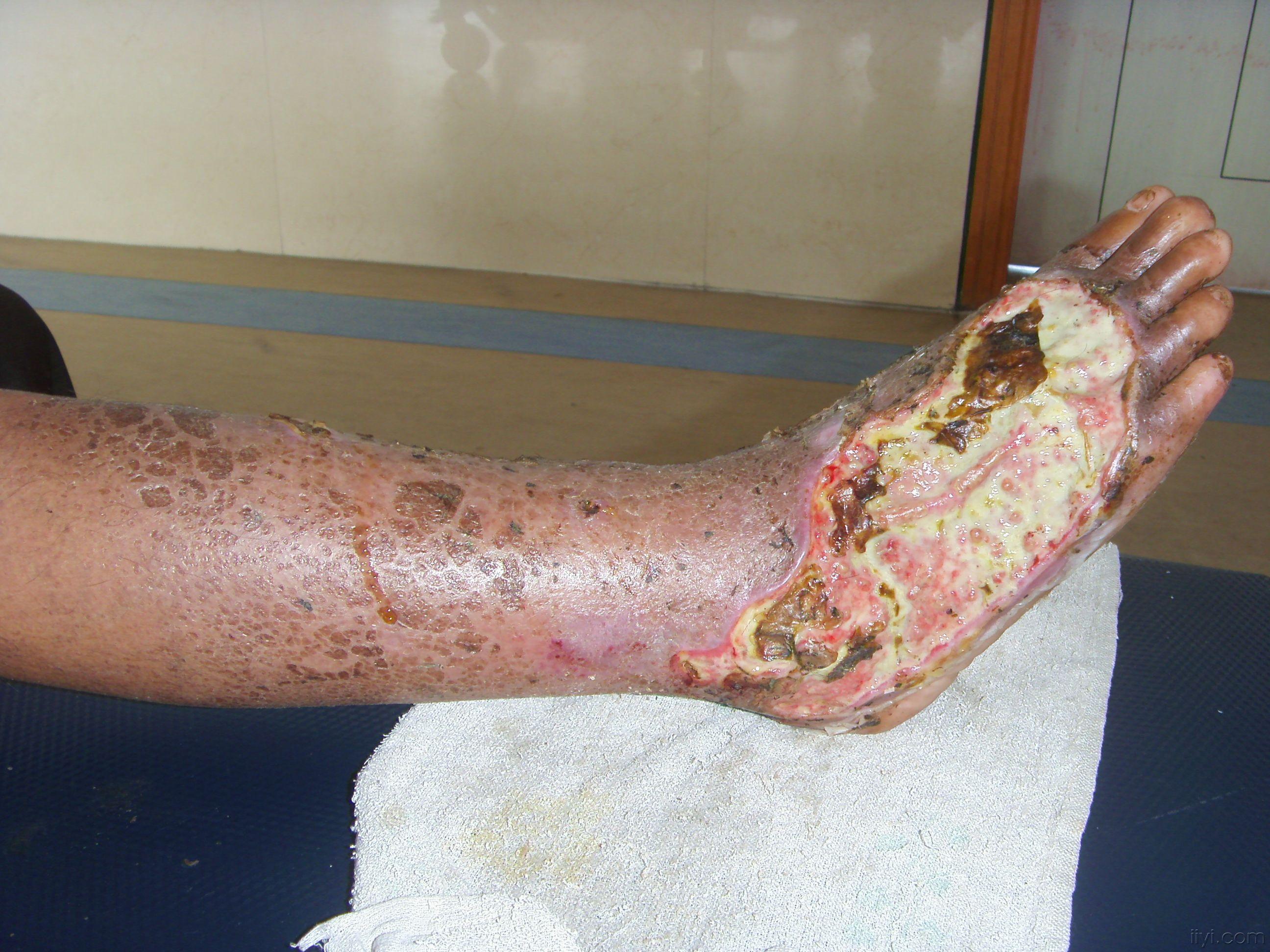 这条腿截还是保